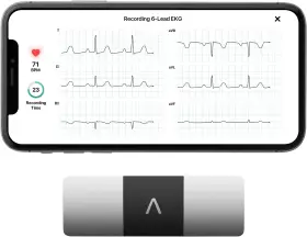 Km-6l-e Alivecor Kardiamobile 6-lead Personal Ekg Monitor Six Views Of The Heart Detects Afib